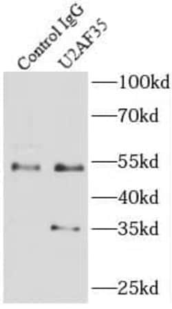 U2AF35 Antibody (1E9), Novus Biologicals 100 &mu;g; Unconjugated:Antibodies,