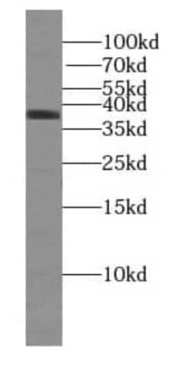 U2AF35 Antibody (1E9), Novus Biologicals 100 &mu;g; Unconjugated:Antibodies,
