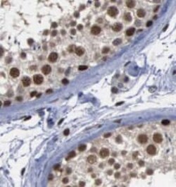 USP13 Antibody (9E6), Novus Biologicals 100 &mu;g; Unconjugated:Antikörper
