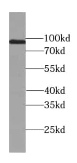 USP13 Antibody (9E6), Novus Biologicals 100 &mu;g; Unconjugated:Antikörper