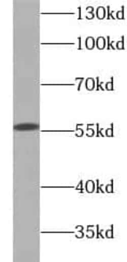 Glucose 6 phosphate isomerase Antibody (4F11), Novus Biologicals 100 &mu;g;
