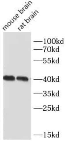 NDRG2 Antibody (4H3), Novus Biologicals 100 &mu;g; Unconjugated:Antibodies,