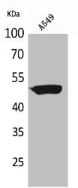 HNF-3 alpha/FoxA1 Antibody [Unconjugated], Novus Biologicals 100 &mu;g;