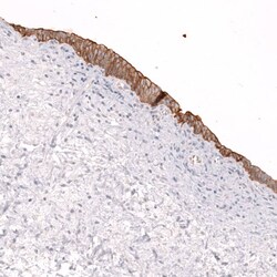 ABCB5 Antibody (CL13618) [Unconjugated], Novus Biologicals 25 &mu;L; Unconjugated:Antibodies,
