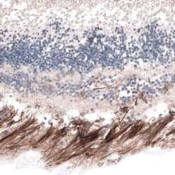 ABCB5 Antibody (CL13618) [Unconjugated], Novus Biologicals 25 &mu;L; Unconjugated:Antibodies,