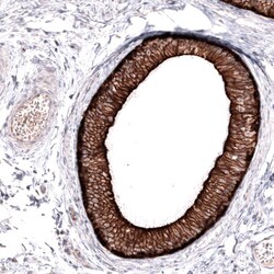 ABCB5 Antibody (CL13618) [Unconjugated], Novus Biologicals 25 &mu;L; Unconjugated:Antibodies,