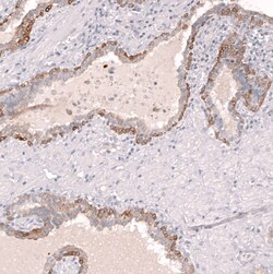 ABCB5 Antibody (CL13618) [Unconjugated], Novus Biologicals 25 &mu;L; Unconjugated:Antibodies,