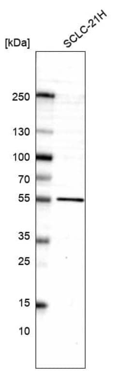 LHX9 Antibody (CL15033) [Unconjugated], Novus Biologicals 100 &mu;L; Unconjugated:Antibodies,