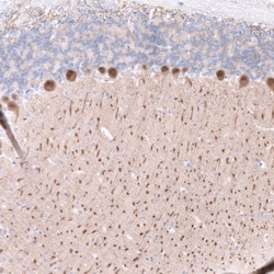 Calbindin D-28K Antibody (CL15060) [Unconjugated], Novus Biologicals:Antibodies:Primary