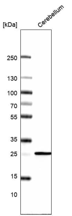 Calbindin D-28K Antibody (CL15060) [Unconjugated], Novus Biologicals:Antibodies:Primary