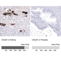 Calbindin D-28K Antibody (CL15060) [Unconjugated], Novus Biologicals™