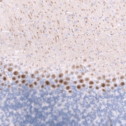 Calbindin D-28K Antibody (CL15065) [Unconjugated], Novus Biologicals 25