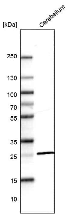 Calbindin D-28K Antibody (CL15065) [Unconjugated], Novus Biologicals 25