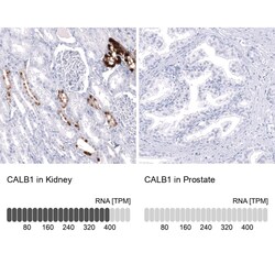 Calbindin D-28K Antibody (CL15065) [Unconjugated], Novus Biologicals 25