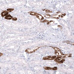 Parvalbumin Antibody (CL15070) [Unconjugated], Novus Biologicals 100 &mu;L;