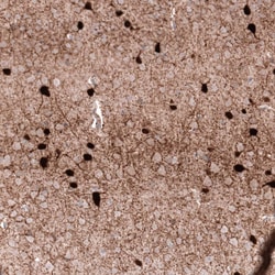 Parvalbumin Antibody (CL15072) [Unconjugated], Novus Biologicals:Antibodies:Primary