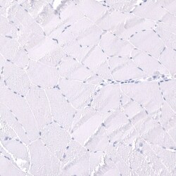 Parvalbumin Antibody (CL15072) [Unconjugated], Novus Biologicals:Antibodies:Primary