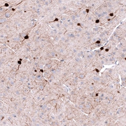 Parvalbumin Antibody (CL15073) [Unconjugated], Novus Biologicals:Antibodies:Primary