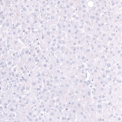 Parvalbumin Antibody (CL15073) [Unconjugated], Novus Biologicals:Antibodies:Primary