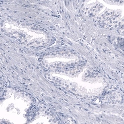 Somatostatin Antibody (CL15075) [Unconjugated], Novus Biologicals:Antibodies:Primary