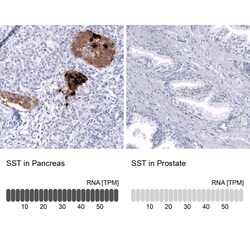 Somatostatin Antibody (CL15075) [Unconjugated], Novus Biologicals:Antibodies:Primary