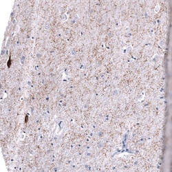 Somatostatin Antibody (CL15075) [Unconjugated], Novus Biologicals:Antibodies:Primary