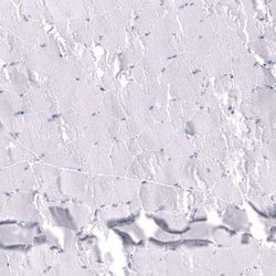 Somatostatin Antibody (CL15076) [Unconjugated], Novus Biologicals:Antibodies:Primary