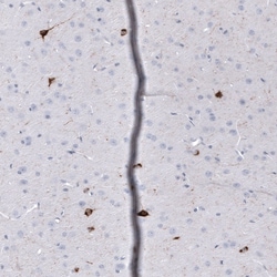 Somatostatin Antibody (CL15076) [Unconjugated], Novus Biologicals:Antibodies:Primary