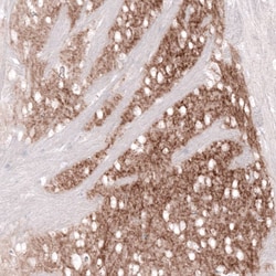 GPR88 Antibody (CL15190) [Unconjugated], Novus Biologicals:Antibodies:Primary