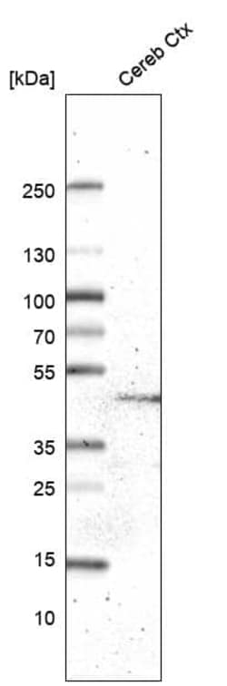 GPR88 Antibody (CL15190) [Unconjugated], Novus Biologicals:Antibodies:Primary