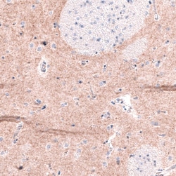 GPR88 Antibody (CL15190) [Unconjugated], Novus Biologicals:Antibodies:Primary
