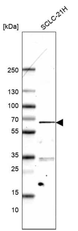 ETV1 Antibody (CL15251) [Unconjugated], Novus Biologicals 100 &mu;L; Unconjugated:Antibodies,