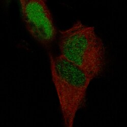 POU3F3 Antibody (CL15302) [Unconjugated], Novus Biologicals 100 &mu;L;