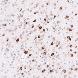 ELAVL2 Antibody (CL15323) [Unconjugated], Novus Biologicals 100 &mu;L;