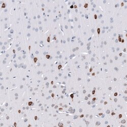ELAVL2 Antibody (CL15323) [Unconjugated], Novus Biologicals 100 &mu;L;