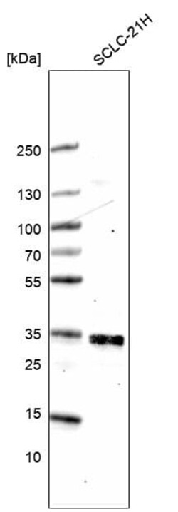 ELAVL2 Antibody (CL15323) [Unconjugated], Novus Biologicals 100 &mu;L;