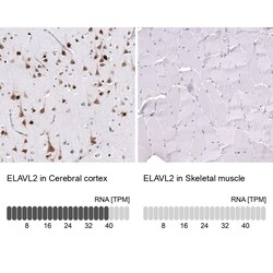 ELAVL2 Antibody (CL15323) [Unconjugated], Novus Biologicals 100 &mu;L;