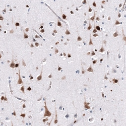 ELAVL2 Antibody (CL15323) [Unconjugated], Novus Biologicals 100 &mu;L;