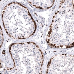 ELAVL2 Antibody (CL15323) [Unconjugated], Novus Biologicals 100 &mu;L;