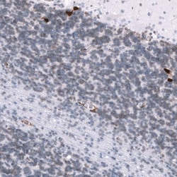 ELAVL2 Antibody (CL15323) [Unconjugated], Novus Biologicals 100 &mu;L;