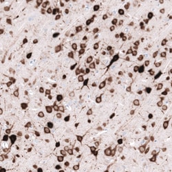ELAVL2 Antibody (CL15329) [Unconjugated], Novus Biologicals 25 &mu;L; Unconjugated:Antibodies,