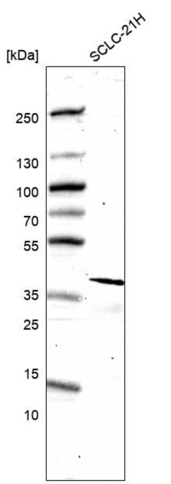 ELAVL2 Antibody (CL15329) [Unconjugated], Novus Biologicals 25 &mu;L; Unconjugated:Antibodies,
