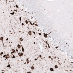 ELAVL2 Antibody (CL15329) [Unconjugated], Novus Biologicals 25 &mu;L; Unconjugated:Antibodies,