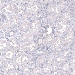 Inhibin beta A Antibody (CL15357) [Unconjugated], Novus Biologicals 100