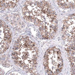 Nectin-3/PVRL3 Antibody (CL15364) [Unconjugated], Novus Biologicals 25