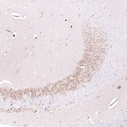 Nectin-3/PVRL3 Antibody (CL15364) [Unconjugated], Novus Biologicals 25