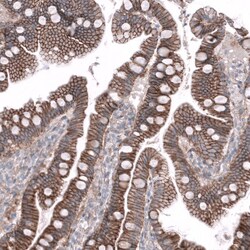 Nectin-3/PVRL3 Antibody (CL15366) [Unconjugated], Novus Biologicals:Antibodies:Primary