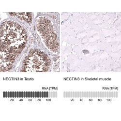 Nectin-3/PVRL3 Antibody (CL15366) [Unconjugated], Novus Biologicals:Antibodies:Primary