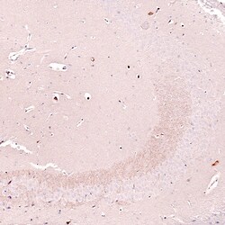 Nectin-3/PVRL3 Antibody (CL15366) [Unconjugated], Novus Biologicals:Antibodies:Primary