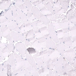 Nectin-3/PVRL3 Antibody (CL15366) [Unconjugated], Novus Biologicals:Antibodies:Primary